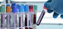 Masernschutzgesetz erleichtert HIV-Tests